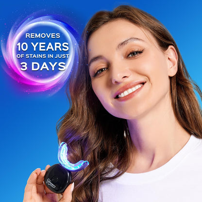 GlowBeam LED Teeth Whitening Kit